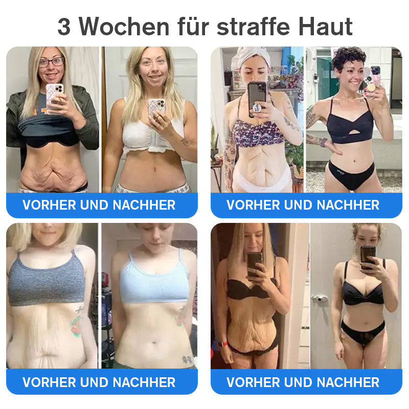 Coolord® Emu Öl Straffend & Anti-Falten Creme🔥Letzter Tag 80% Rabatt 👩 BfArM Zertifiziert – Klinisch Bewährte Festigung, Straffung & Beruhigende Reparatur 🌿