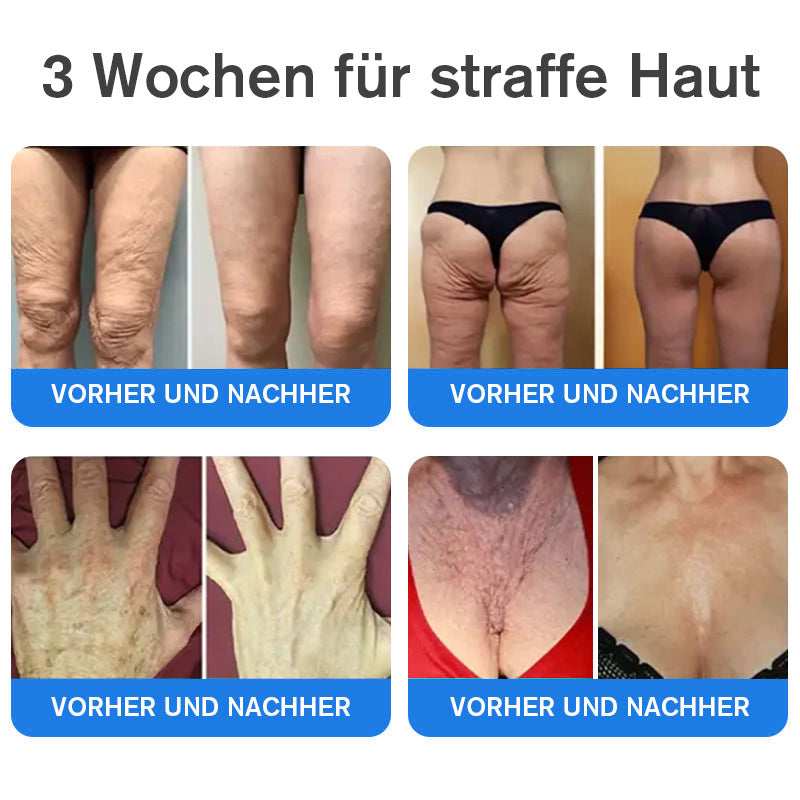 Coolord® Emu Öl Straffend & Anti-Falten Creme🔥Letzter Tag 80% Rabatt 👩 BfArM Zertifiziert – Klinisch Bewährte Festigung, Straffung & Beruhigende Reparatur 🌿