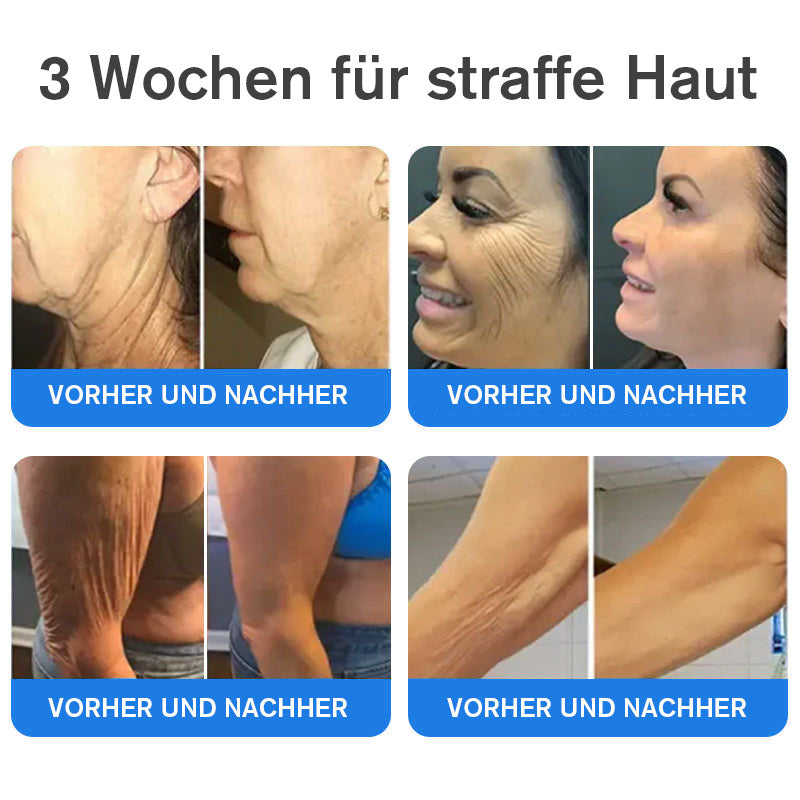 Coolord® Emu Öl Straffend & Anti-Falten Creme🔥Letzter Tag 80% Rabatt 👩 BfArM Zertifiziert – Klinisch Bewährte Festigung, Straffung & Beruhigende Reparatur 🌿