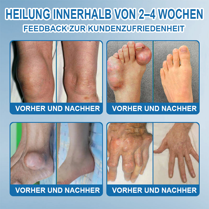 🇩🇪 LOTMAY® BPC-157 💙Creme zur Behandlung von Gelenken und Muskeln 🦴 Behandelt Arthritis, Neuropathie, Rheuma, Sportverletzungen & mehr 🌹