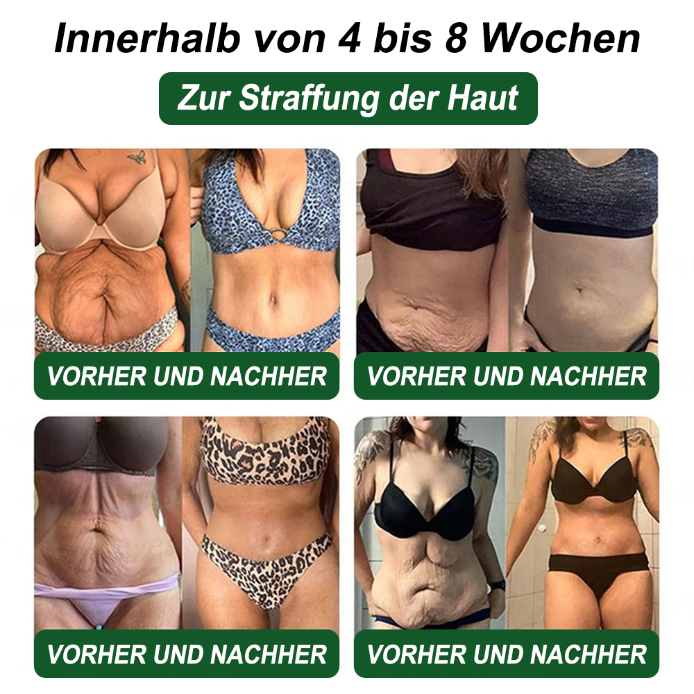 🇩🇪Online-Shop🍀Croaie® NAD+ GLP-1 Fit & Vital Oral Lösung (⚡1× täglich) ✅ Geeignet für Fettleibigkeit, Herz-Kreislauf-Gesundheit, Diabetes, Schlafapnoe, Darmgesundheit, Gelenkprobleme und weitere gesundheitliche Bedürfnisse