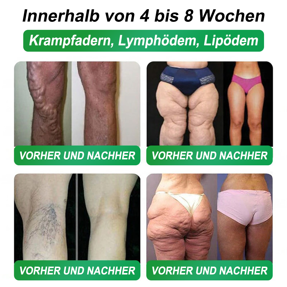 🇩🇪Online-Shop🍀Croaie® NAD+ GLP-1 Fit & Vital Oral Lösung (⚡1× täglich) ✅ Geeignet für Fettleibigkeit, Herz-Kreislauf-Gesundheit, Diabetes, Schlafapnoe, Darmgesundheit, Gelenkprobleme und weitere gesundheitliche Bedürfnisse