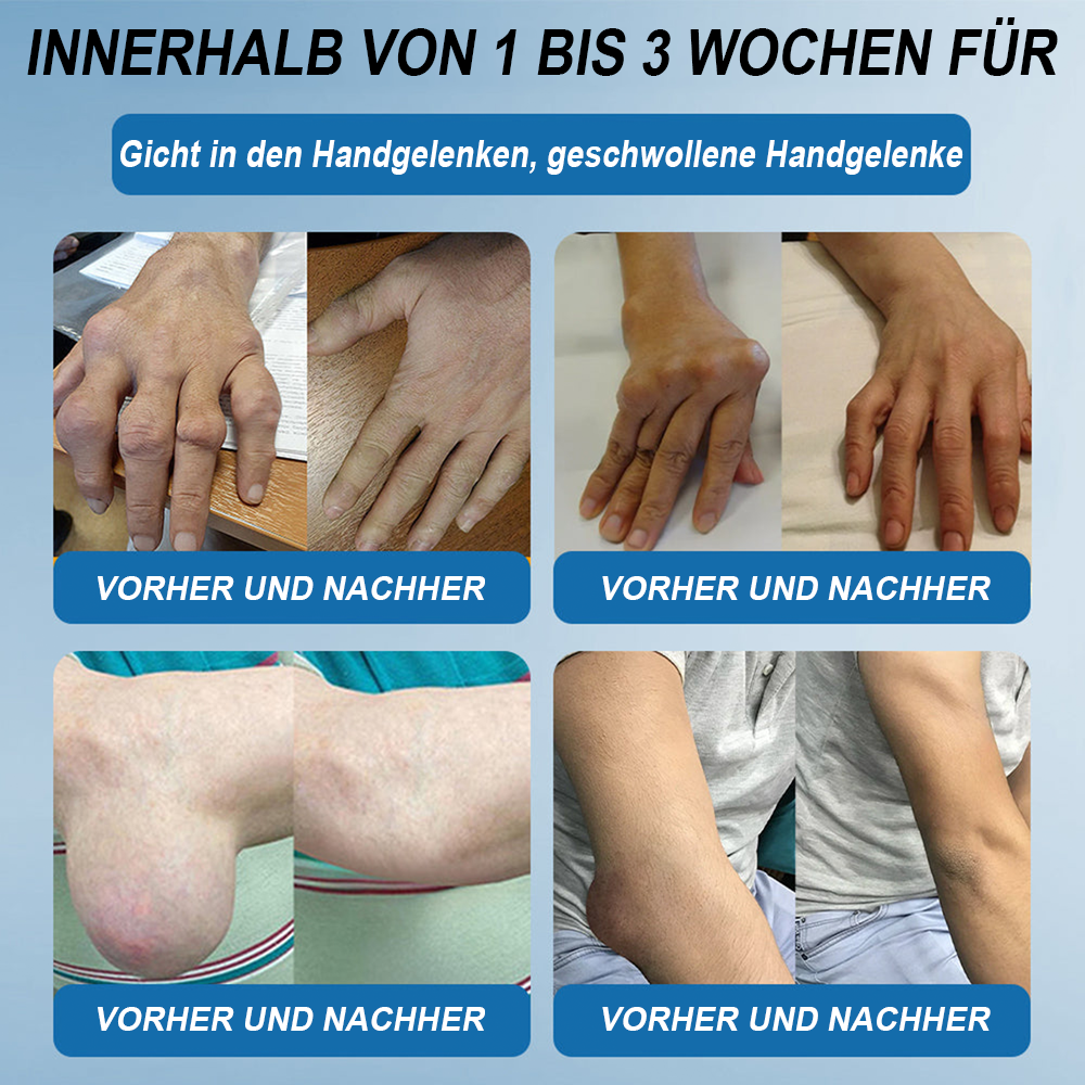 🇩🇪 LOTMAY® BPC-157 💙Creme zur Behandlung von Gelenken und Muskeln 🦴 Behandelt Arthritis, Neuropathie, Rheuma, Sportverletzungen & mehr 🌹