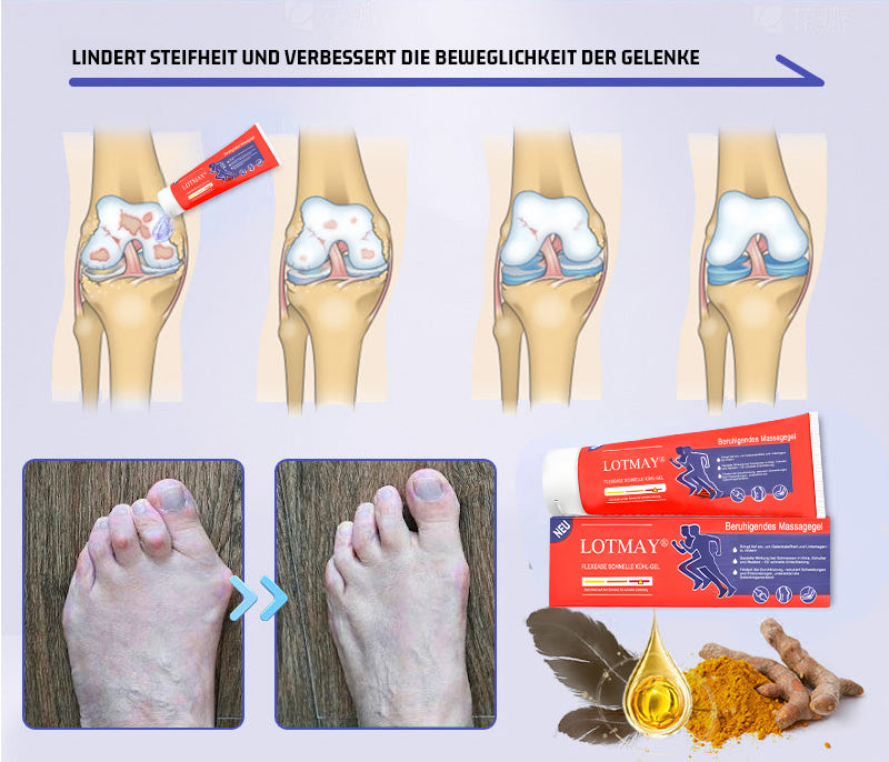Offizieller Shop | LOTMAY® Kurkuma- & Emuöl Arthritis Beruhigendes Schmerz-Massagegel