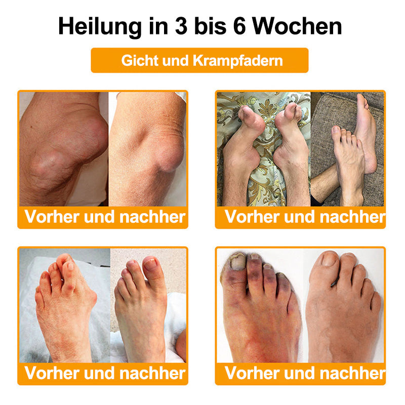 RAINDEW®🔥 BIENGIFT-LITHOSPERMUM Schmerzlindemde Creme zur Knochenheilung👑👑 (Speziell für ältere Erwachsene)