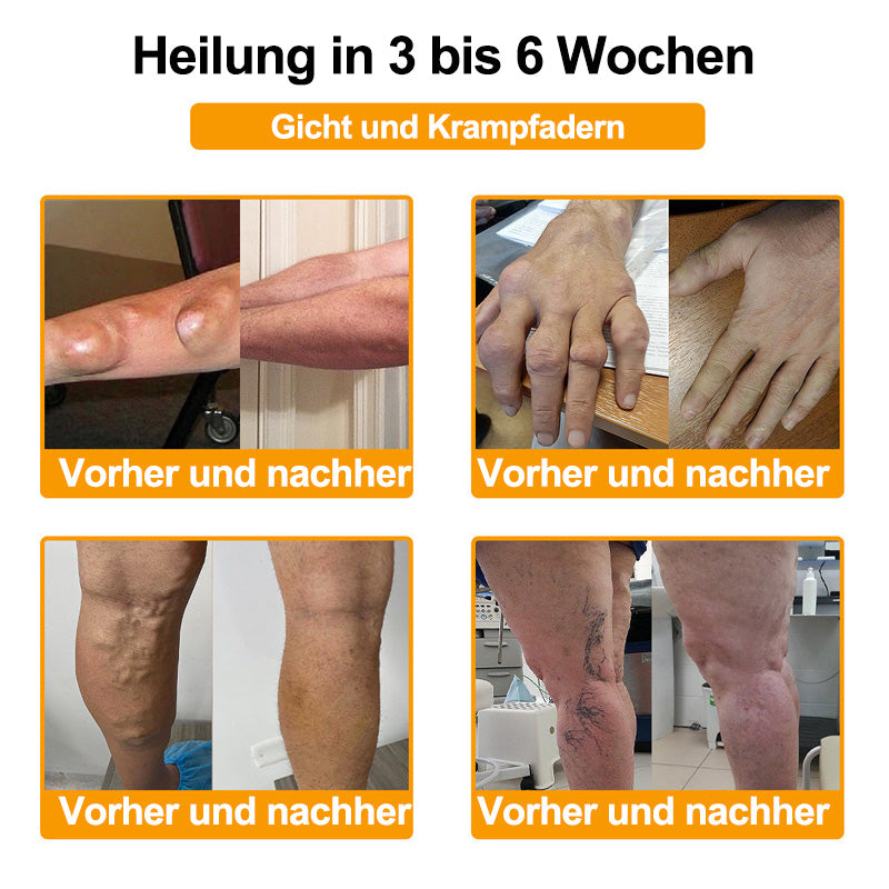RAINDEW®🔥 BIENGIFT-LITHOSPERMUM Schmerzlindemde Creme zur Knochenheilung👑👑 (Speziell für ältere Erwachsene)
