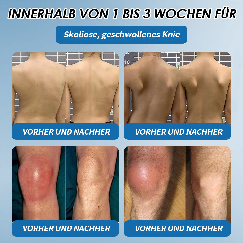 🇩🇪 LOTMAY® BPC-157 💙Creme zur Behandlung von Gelenken und Muskeln 🦴 Behandelt Arthritis, Neuropathie, Rheuma, Sportverletzungen & mehr 🌹