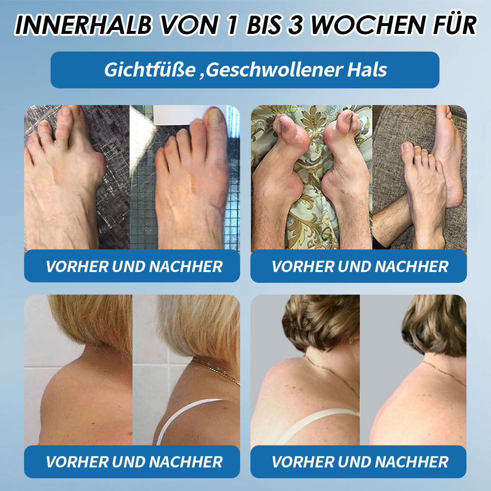 🇩🇪 LOTMAY® BPC-157 💙Creme zur Behandlung von Gelenken und Muskeln 🦴 Behandelt Arthritis, Neuropathie, Rheuma, Sportverletzungen & mehr 🌹