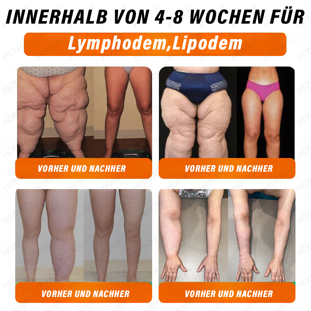 🔥 Letzter Platz verfügbar! ⚡ Sichere dir 30 % RABATT – nur für kurze Zeit! HONXI® NAD+ GLP-1 bildgebende Droppar – geeignet bei Fettleibigkeit, Diabetes und Herz-Kreislauf-Erkrankungen