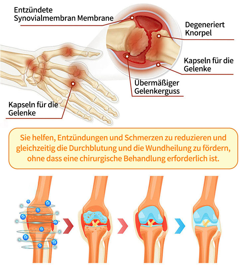 🇩🇪 LOTMAY® BPC-157 💙Creme zur Behandlung von Gelenken und Muskeln 🦴 Behandelt Arthritis, Neuropathie, Rheuma, Sportverletzungen & mehr 🌹