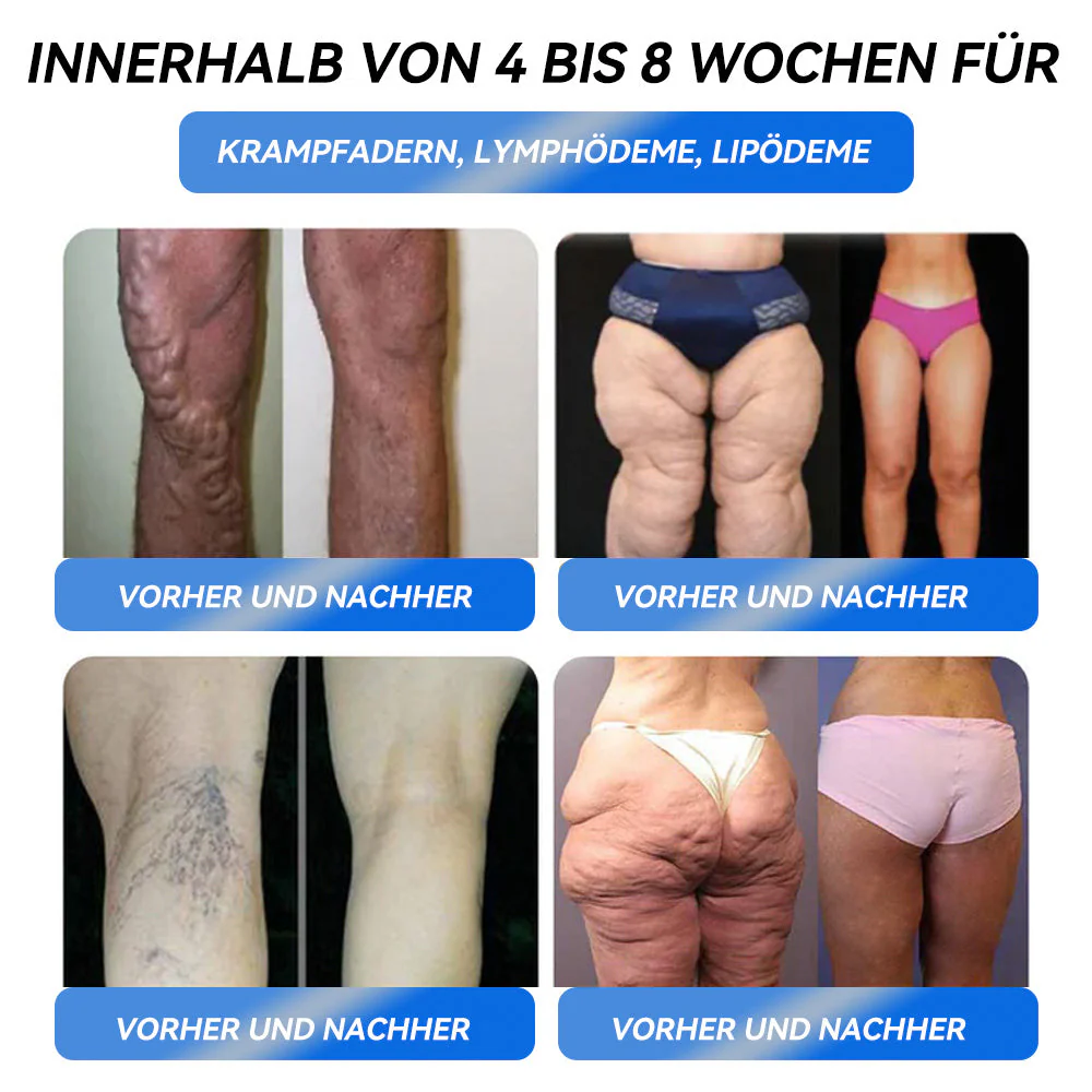 Honxi® GLP-1 Max Schlankheits-Trinklösung 🔥7 Tage sichtbare Wirkung, keine Nebenwirkungen, geeignet für alle Altersgruppen