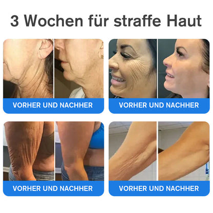 Coolord® Emu Öl Straffend & Anti-Falten Creme🔥Letzter Tag 80% Rabatt 👩 BfArM Zertifiziert – Klinisch Bewährte Festigung, Straffung & Beruhigende Reparatur 🌿