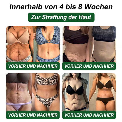 🇩🇪Online-Shop🍀Croaie® NAD+ GLP-1 Fit & Vital Oral Lösung (⚡1× täglich) ✅ Geeignet für Fettleibigkeit, Herz-Kreislauf-Gesundheit, Diabetes, Schlafapnoe, Darmgesundheit, Gelenkprobleme und weitere gesundheitliche Bedürfnisse