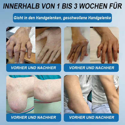 🇩🇪 LOTMAY® BPC-157 💙Creme zur Behandlung von Gelenken und Muskeln 🦴 Behandelt Arthritis, Neuropathie, Rheuma, Sportverletzungen & mehr 🌹